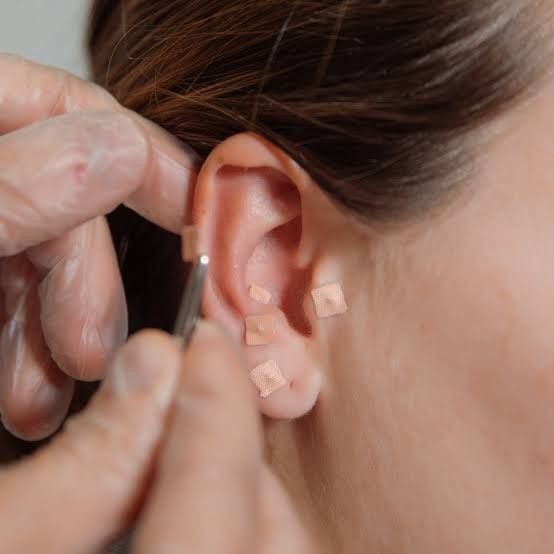 Auriculoterapia thumbnail