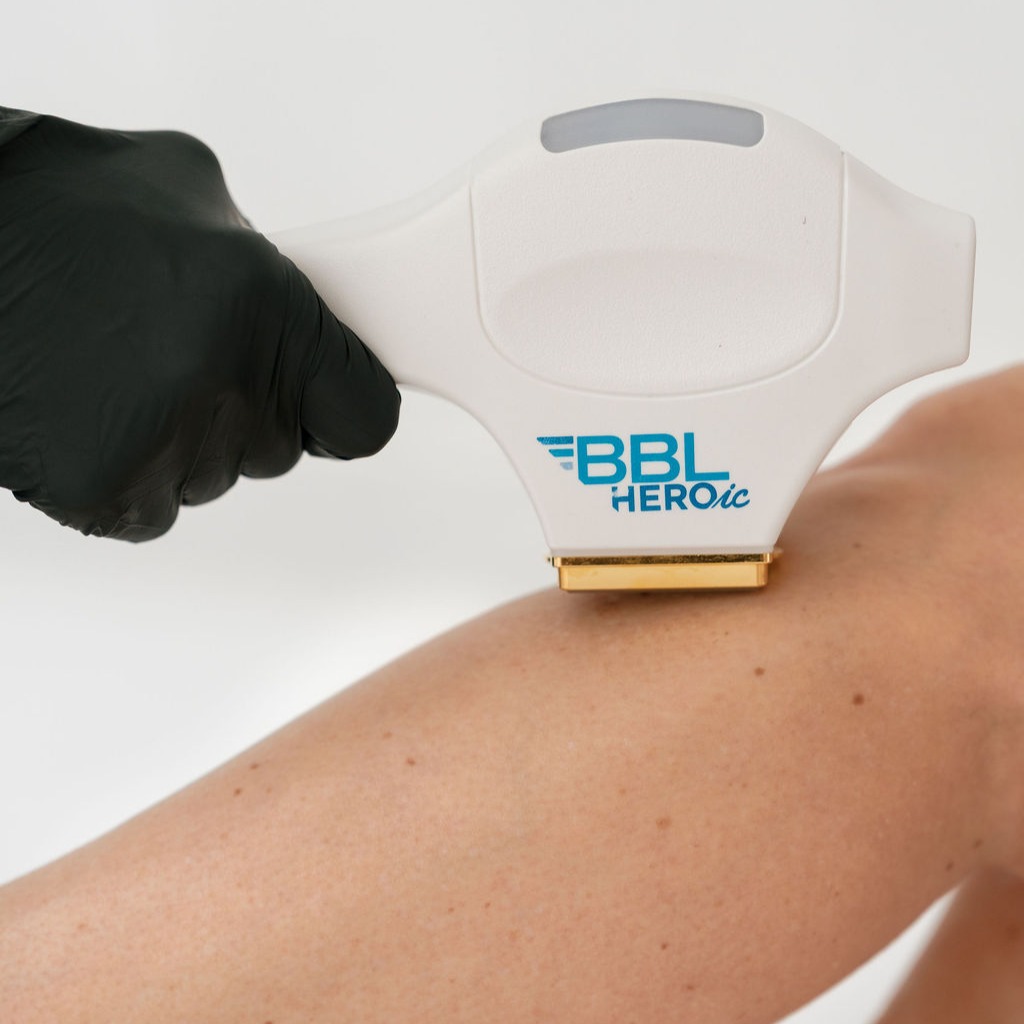 LHR Package of 6: Large Areas (Savings of $350) thumbnail