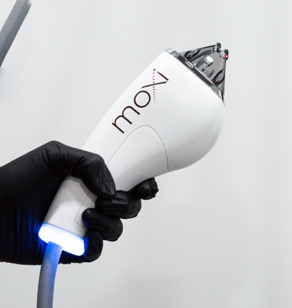 PDGF + BBL HEROic + MOXI: $1,450 February special thumbnail