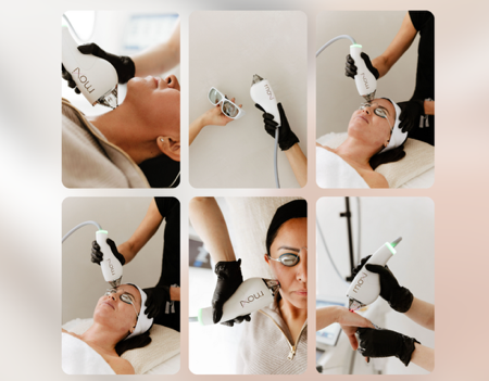 PDGF + BBL HEROic + MOXI: $1,450 February special Targets sun damage, uneven tone, and texture while supporting healing and firmness. thumbnail