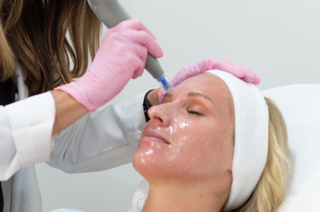 Microneedling + PDGF Series: 3 treatments for $1,600 Supports collagen, improves texture, and enhances skin regeneration. thumbnail