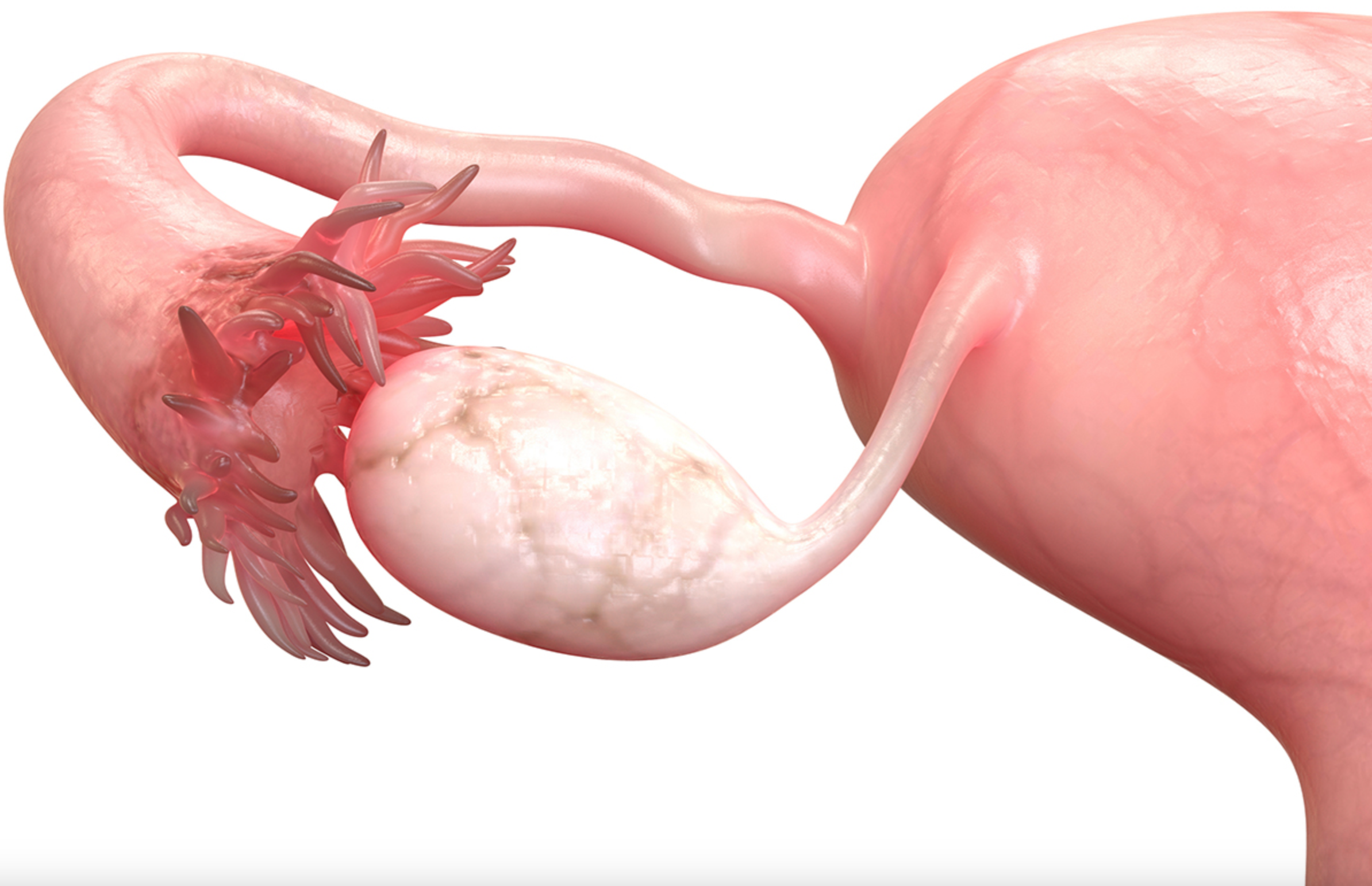 Softening tough tissue in aging ovaries may help fight infertility thumbnail