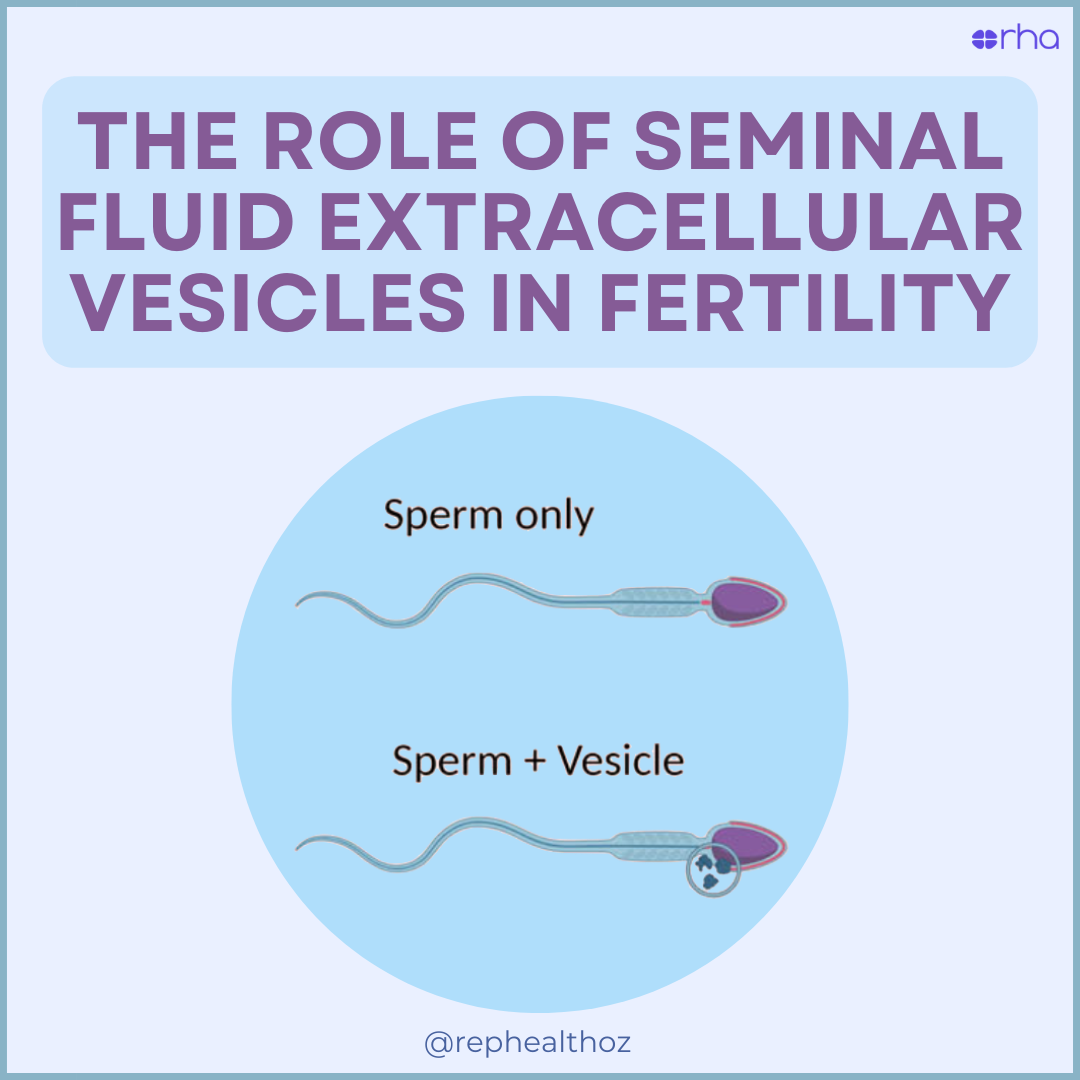 The Role of Seminal Fluid Extracellular Vesicles (SFEVs) in Fertility thumbnail