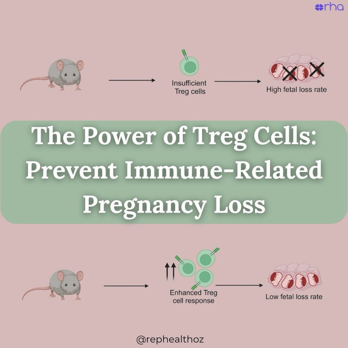 IL-2 Complexed With Anti–IL-2 Antibody Expands the Maternal T-Regulatory Cell Pool and Alleviates Fetal Loss in Abortion-Prone Mice thumbnail
