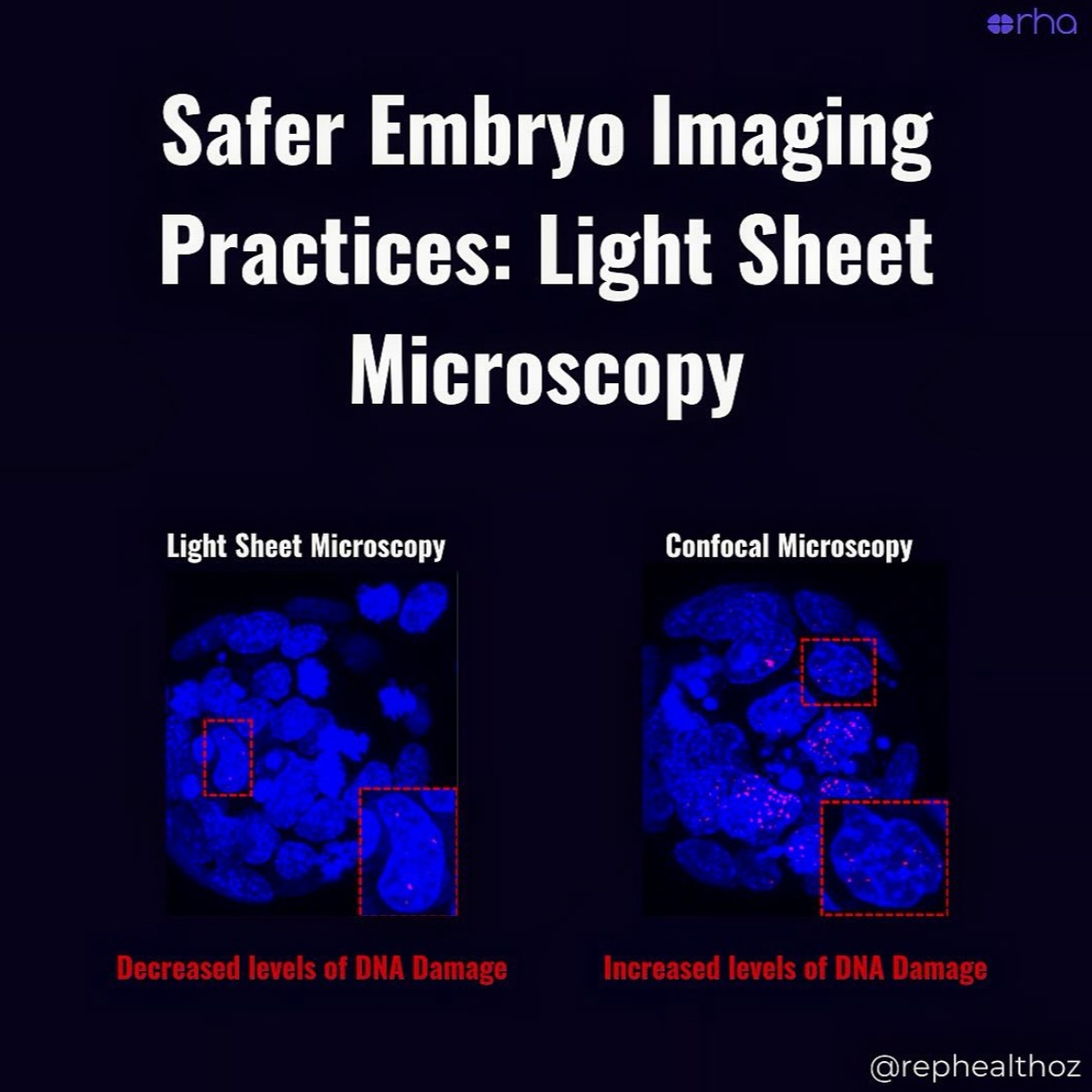Quantifying DNA damage following light sheet and confocal imaging of the mammalian embryo thumbnail
