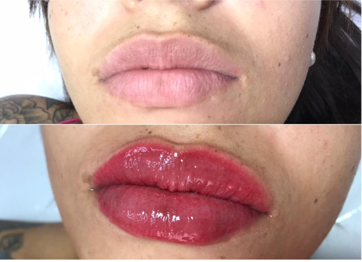 Micropigmentação Labial  thumbnail