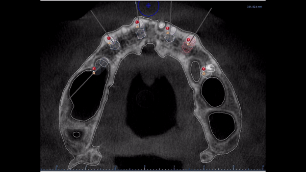 Lista de Tratamentos thumbnail