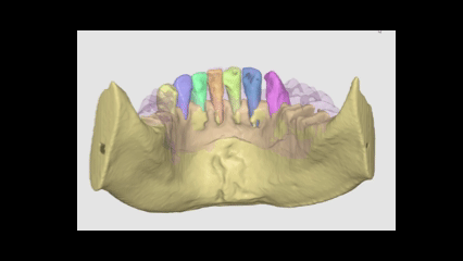 Casos clinicos - vídeos thumbnail