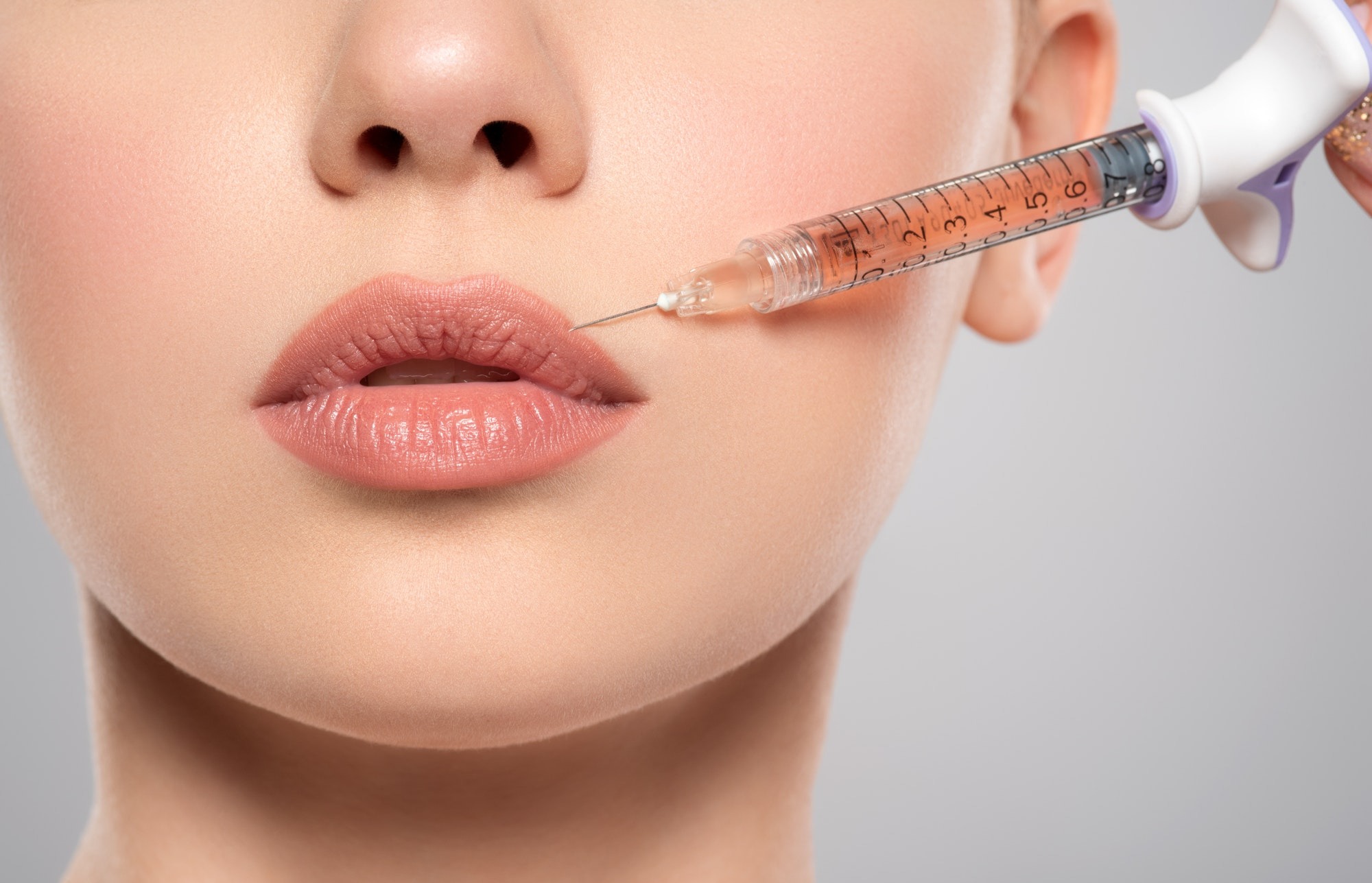 Preenchimento Labial  thumbnail