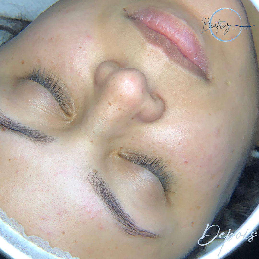 Estética  thumbnail
