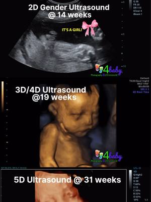 POV: You booked ALL our ultrasound services and now you're obsessed 🤰✨ 2D vs 3D vs 5D - the glow up is REAL  👀 Link in b