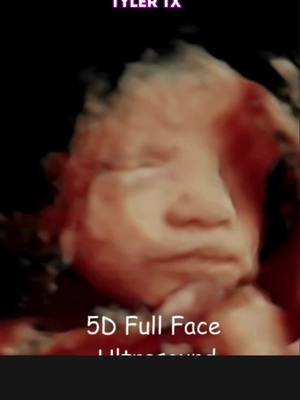 #genderreveal#babytikok #pregnanttiktok  📲Book your 3D/4D/5D or Gender Revel session with DFW#1 rated ultrasound & photo