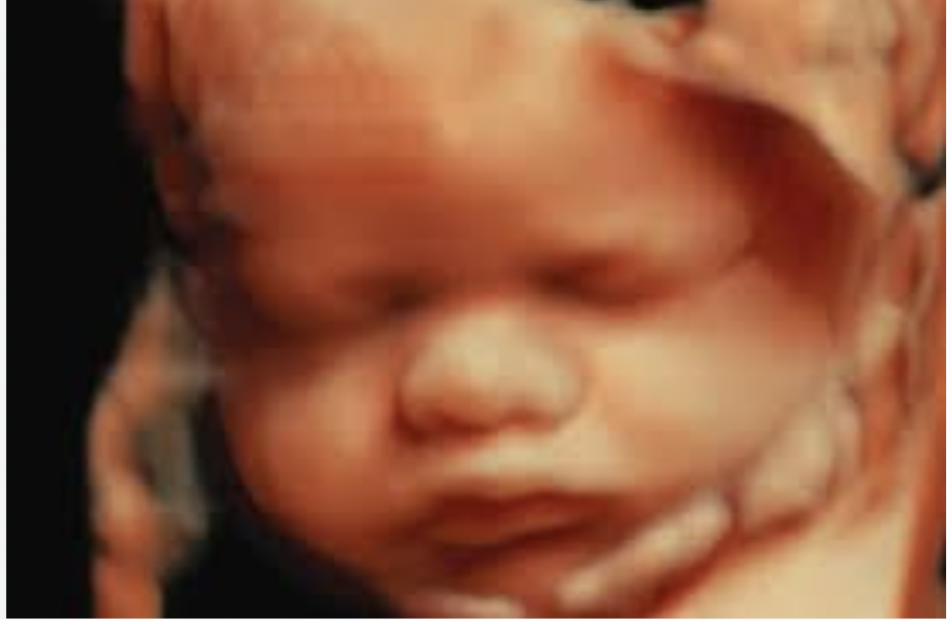 ULTRASOUND Packages thumbnail