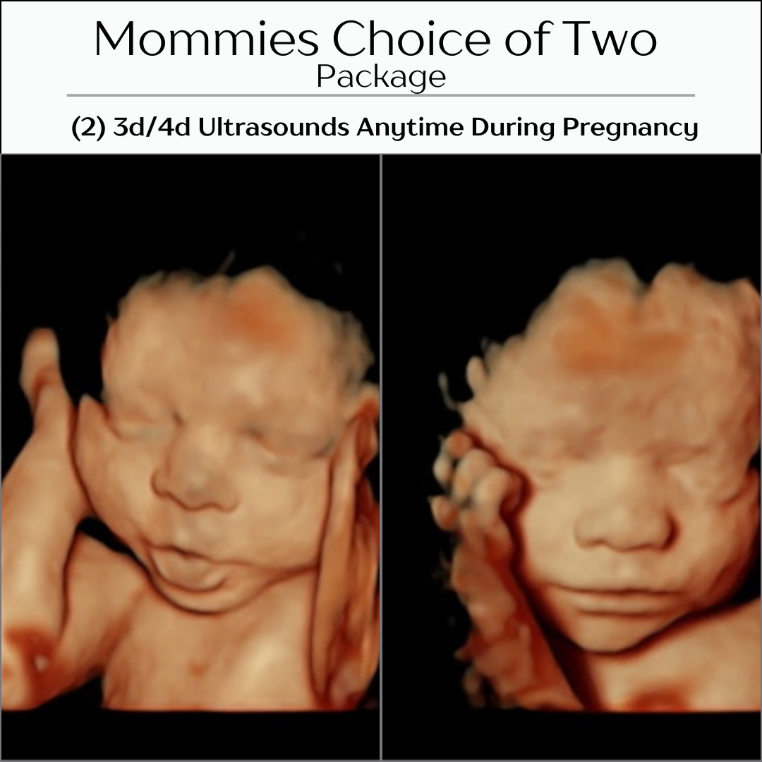 Mommies Choice of 2 Ultrasounds  thumbnail
