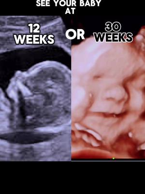 2 chances to see your little one…whenever YOU’RE ready!💕 Don’t wait—pregnancy goes fast! Book today 📞817-590-0200 🔗www.4