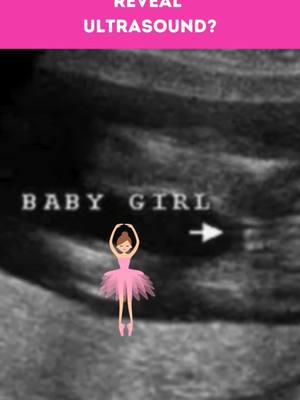 Did you know? The gender of your baby can often be determined during a gender reveal ultrasound starting as early as 14 