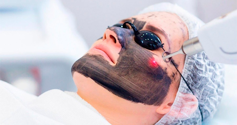 Peeling de Hollywood thumbnail