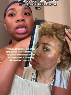 The worlds first ever donkey milk retinol has hit the stage 😀 look this  amazing review we got from our client Jalysa wh