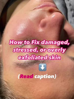 Try the #1 best selling Barrier balm  now back by popular demand + Revamped.  We added ceramides to the last formula so 