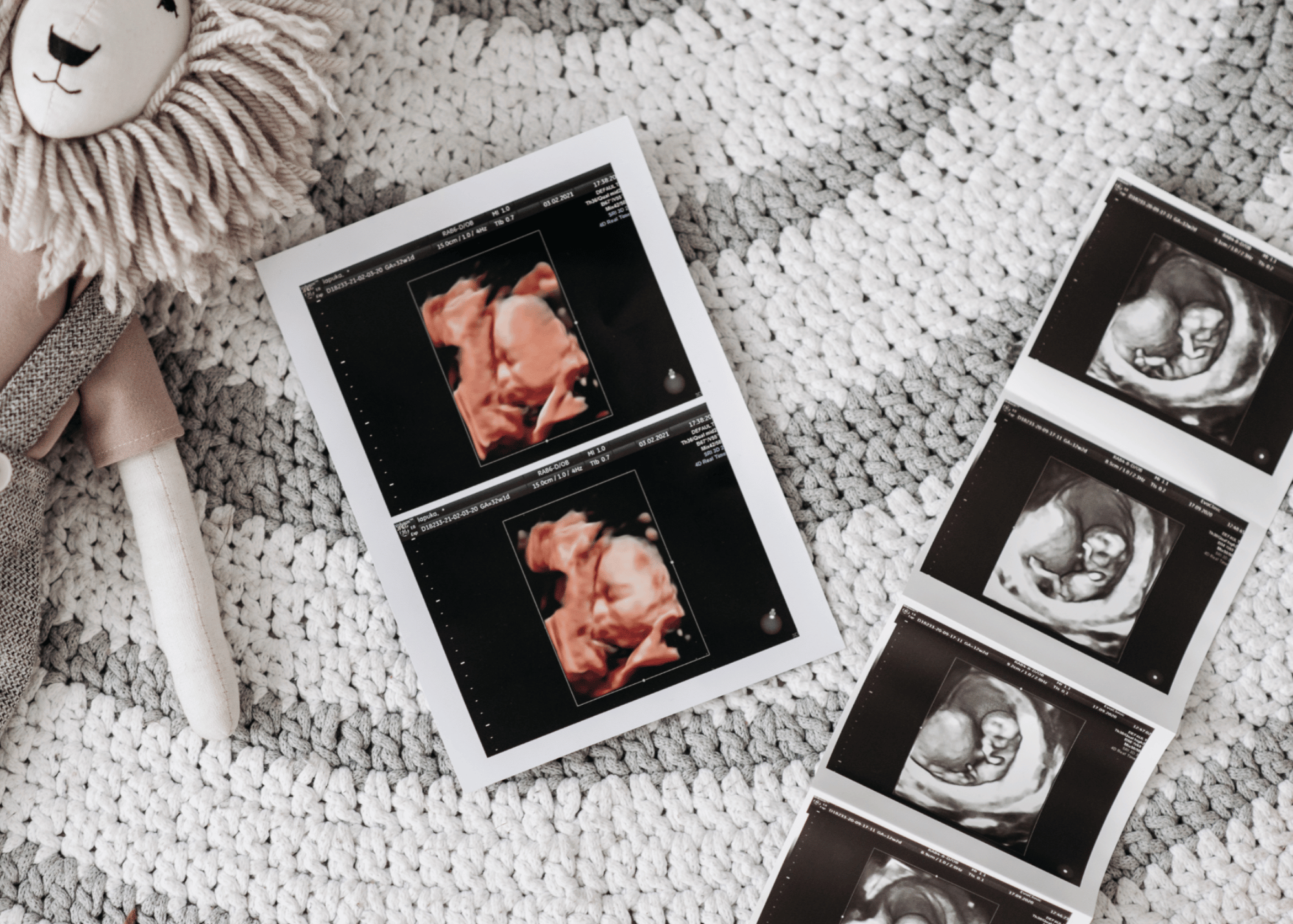 Webinaire Gratuit: grossesse et accouchement au Québec comment ça marche ?  thumbnail