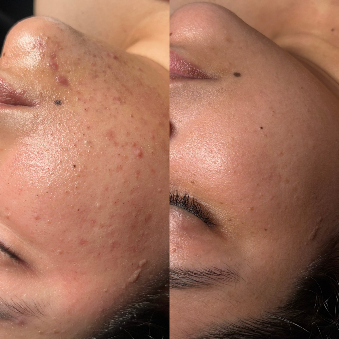 Before & Afters thumbnail