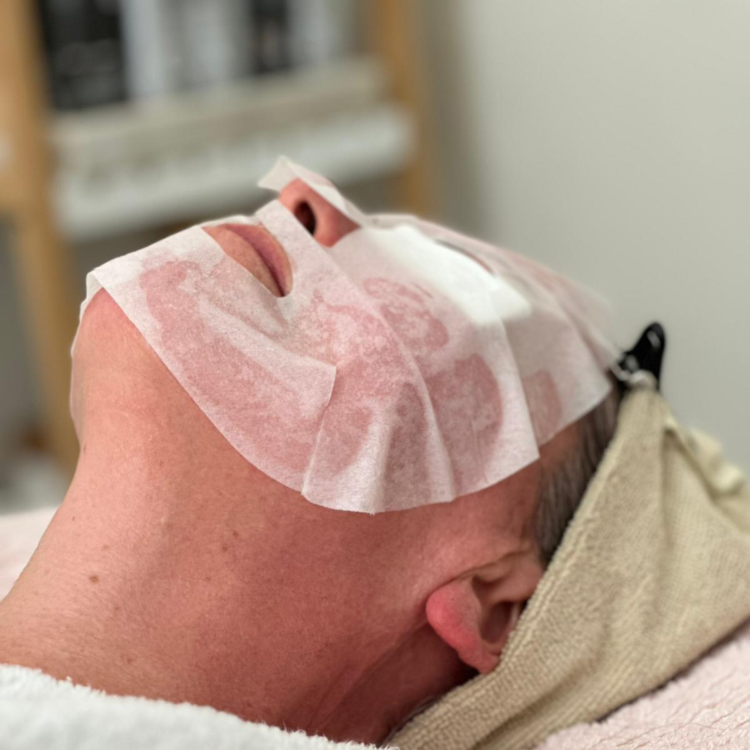 Medi Facials/Peels thumbnail
