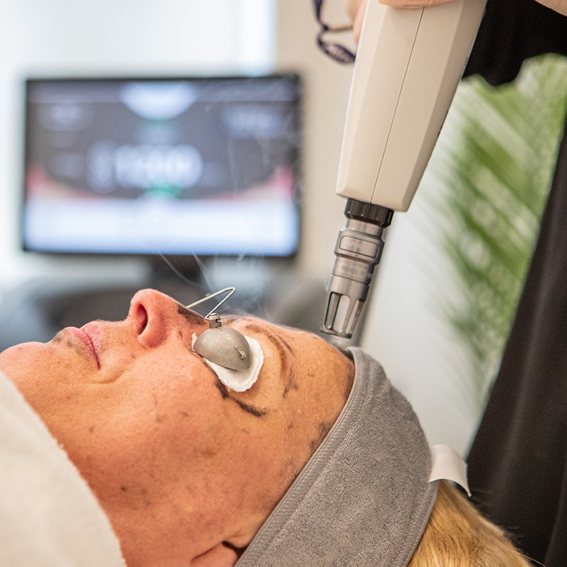Laser Treatments thumbnail