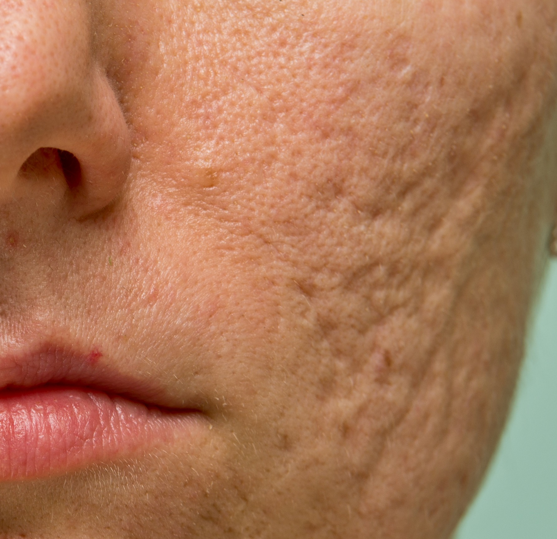 Cicatrizes thumbnail