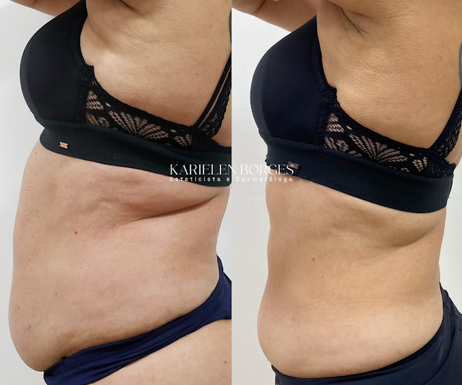 Drenagem linfática integrativa Maf thumbnail