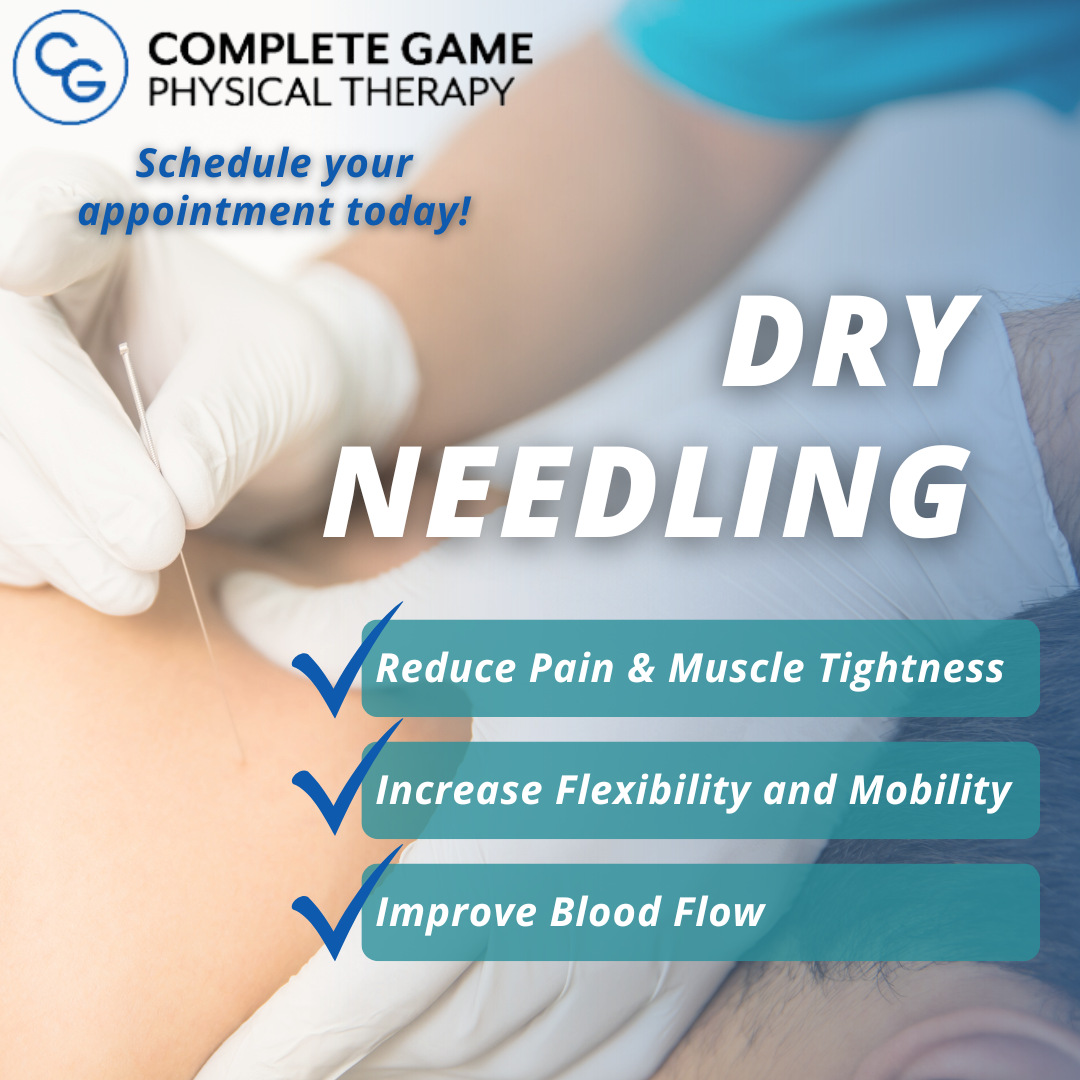 We Offer Dry Needling! Click here to learn more & request your appointment thumbnail